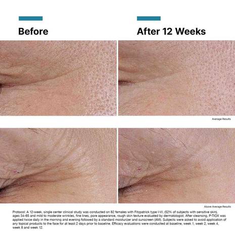 SkinCeuticals P-TIOX Wrinkle Modulating Peptide Serum (1 fl. oz.)