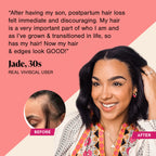 Viviscal Hair Growth Supplements for Women, Thicker Fuller Hair Support for Thinning Hair and Hair Loss, with Biotin and Marine Collagen, Drug-Free, 180 Tablets, 90-Day Supply